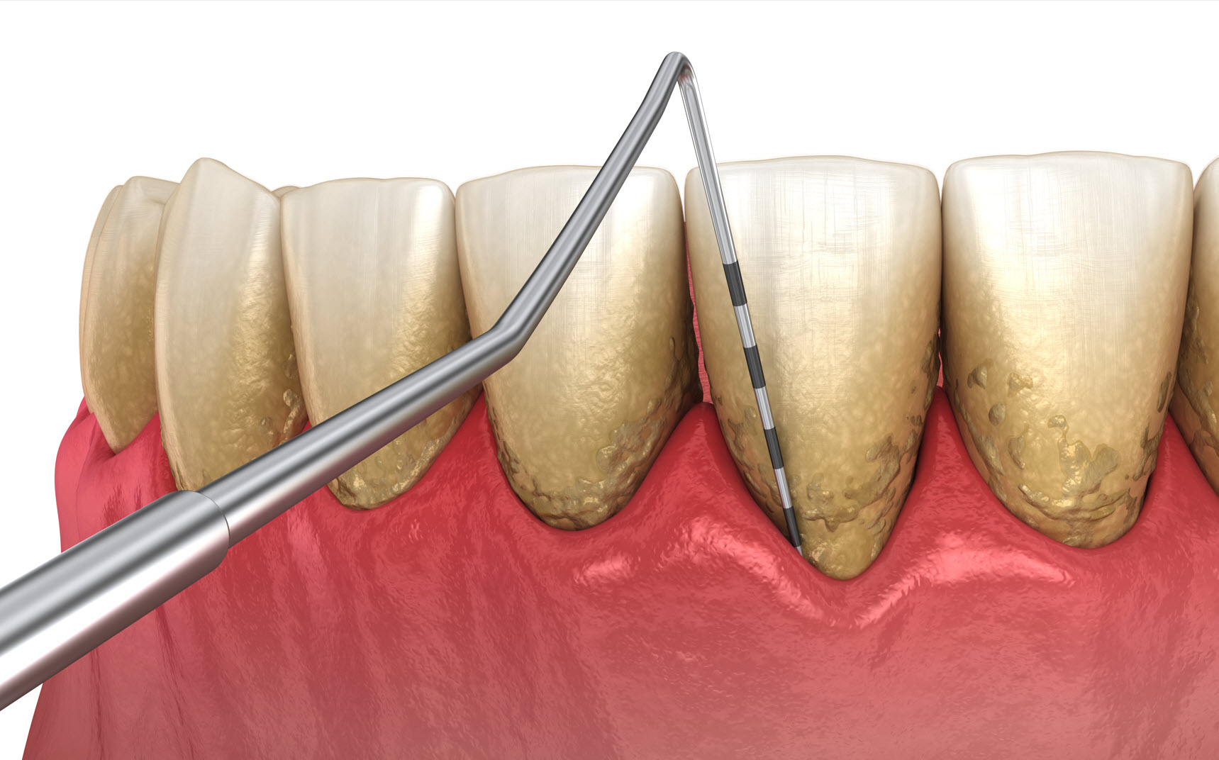 Periodontal specialists in Brisbane