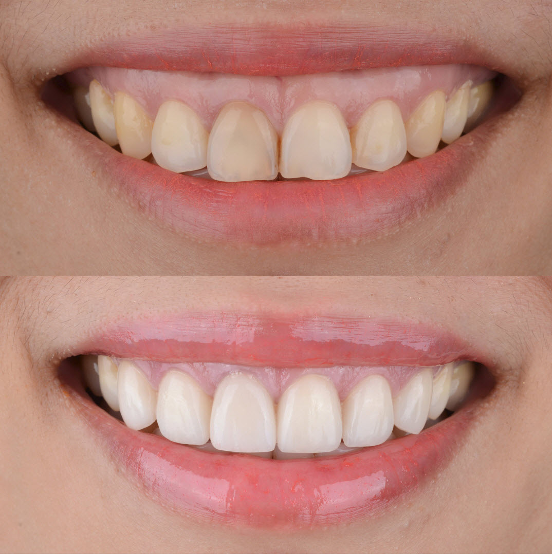 Innovative cosmetic dentistry solutions in Brisbane