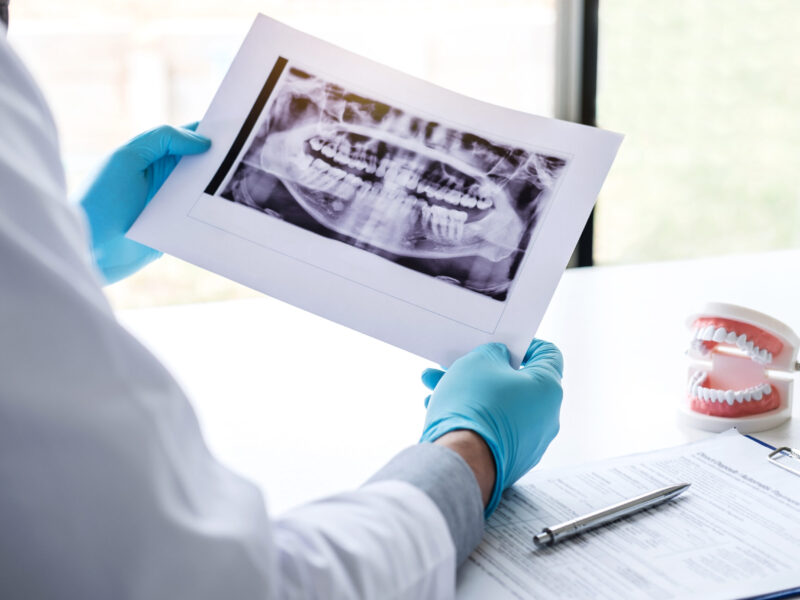 Dentist reviewing a panoramic dental X-ray during a patient consultation